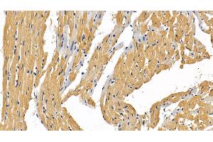 Detection of RIPK1 in Rat Cardiac Muscle Tissue using Polyclonal Antibody to Receptor Interacting Serine Threonine Kinase 1 (RIPK1) (RIPK1 antibody  (AA 1-179))