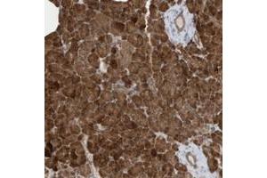 Immunohistochemical staining of human pancreas with CLCN4 polyclonal antibody  shows strong cytoplasmic positivity in exocrine cells.
