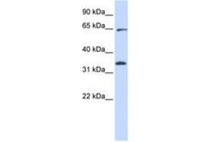 Image no. 1 for anti-Ras Homolog Gene Family, Member T1 (RHOT1) (AA 396-445) antibody (ABIN6740909) (RHOT1 antibody  (AA 396-445))