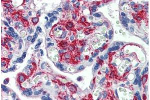 Human Placenta: Formalin-Fixed, Paraffin-Embedded (FFPE) (GPR6 antibody  (N-Term))
