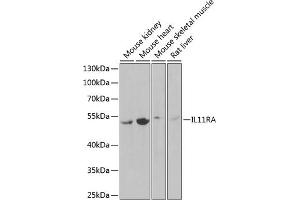 Western blot analysis of extracts of various cell lines, using IL11RA Antibody (ABIN6129037, ABIN6142294, ABIN6142295 and ABIN6222319) at 1:1000 dilution. (IL11RA antibody  (AA 30-290))