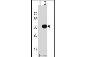 Western blot analysis of MOSC2 (arrow) using rabbit polyclonal MOSC2 Antibody (C-term) (ABIN652632 and ABIN2842422).
