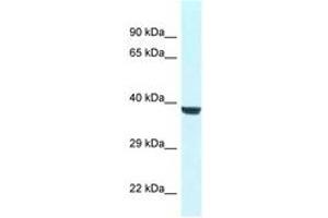 Image no. 1 for anti-WD Repeat Domain 45B (WDR45B) (AA 65-114) antibody (ABIN6747425) (WD Repeat Domain 45B (WDR45B) (AA 65-114) antibody)
