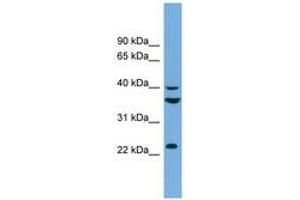 Image no. 1 for anti-SUMO1 Activating Enzyme Subunit 1 (SAE1) (AA 71-120) antibody (ABIN6743622) (SAE1 antibody  (AA 71-120))