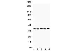 Western blot testing of HOXA11 antibody and Lane 1:  rat brain (Homeobox A11 antibody  (AA 74-245))