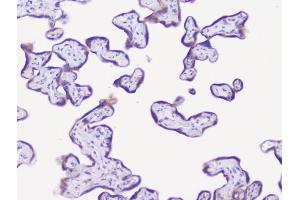 IHC analysis of NSE using anti-NSE antibody (ABIN6719549). (ENO2/NSE antibody)