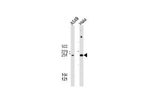All lanes : Anti-WNK1 Antibody (C-Term) at 1:2000 dilution Lane 1: A549 whole cell lysate Lane 2: Hela whole cell lysate Lysates/proteins at 20 μg per lane. (WNK1 antibody  (AA 1848-1882))
