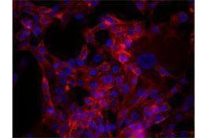Immunofluorescence (IF) image for anti-CD44 (CD44) antibody (Alexa Fluor 647) (ABIN2657791) (CD44 antibody  (Alexa Fluor 647))