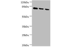 Western blot All lanes: CDH6 antibody at 6 μg/mL Lane 1: 293T whole cell lysate Lane 2: Hela whole cell lysate Lane 3: A549 whole cell lysate Secondary Goat polyclonal to rabbit IgG at 1/10000 dilution Predicted band size: 89, 74 kDa Observed band size: 89 kDa (CDH6 antibody  (AA 1-250))