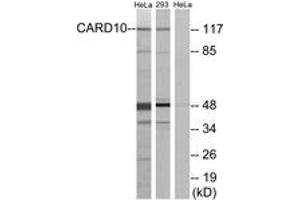 Western blot analysis of extracts from HeLa/293 cells, using CARD10 Antibody. (CARD10 antibody  (AA 481-530))