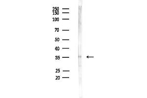 anti-OR2T5/2T29 antibody