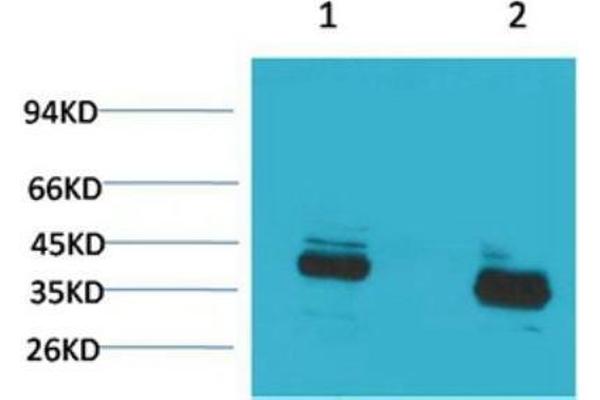 S100G antibody