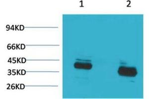 Western Blot (WB) analysis of 1) Mouse Brain Tissue, 2) Rat Brain Tissue with CABP Rabbit Polyclonal Antibody diluted at 1:2000. (S100G antibody)