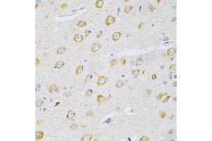 Immunohistochemistry of paraffin-embedded rat brain using OLR1 Antibody. (OLR1 antibody)