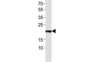 Western blot analysis of lysate from EPO recombinant protein using Erythropoietin antibody at 1:1000. (EPO antibody  (AA 20-48))