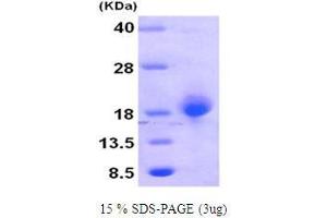 Figure annotation denotes ug of protein loaded and % gel used. (GADD45B Protein (AA 1-160))