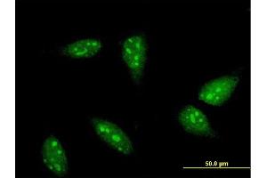 Immunofluorescence of monoclonal antibody to RNF6 on HeLa cell. (RNF6 antibody  (AA 1-100))
