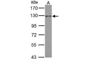 WB Image ADAM17 antibody [C2C3], C-term detects ADAM17 protein by Western blot analysis. (ADAM17 antibody  (C-Term))