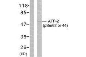 Western blot analysis of extracts from HeLa cells treated with TNF-alpha, using ATF2 (Phospho-Ser62 or 44) Antibody.