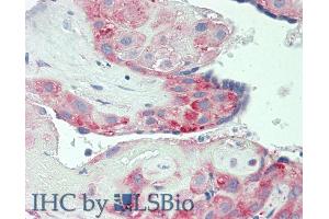 Detection of CD30L in Human Placenta Tissue using Polyclonal Antibody to Cluster Of Differentiation 30 Ligand (CD30L) (TNFSF8 antibody  (AA 68-231))