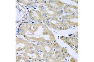 Immunohistochemistry of paraffin-embedded human stomach using HS1BP3 antibody (ABIN5974534) at dilution of 1/100 (40x lens). (HS1BP3 antibody)