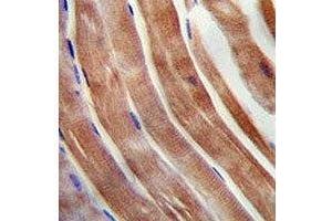 KEAP1 antibody immunohistochemistry analysis in formalin fixed and paraffin embedded human skeletal muscle. (KEAP1 antibody  (AA 422-449))