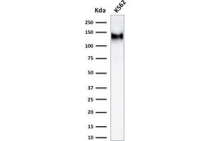 Western Blot Analysis of K562 cell lysate using CD43 Mouse Recombinant Monoclonal Antibody (rSPN/1094). (Recombinant CD43 antibody)