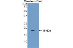 Detection of Recombinant MAPKSP1, Human using Polyclonal Antibody to Mitogen Activated Protein Kinase Scaffold Protein 1 (MAPKSP1) (MAPKSP1 antibody  (AA 1-124))