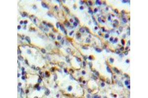 IHC-P analysis of Liver tissue, with DAB staining. (TLR6 antibody  (AA 608-796))