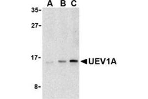 Western blot analysis of UEV1A in Jurkat cell lysates with this product at (A) 1, (B) 2, and (C) 4 μg/ml.