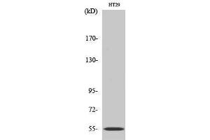 Western Blotting (WB) image for anti-Cytochrome P450, Family 2, Subfamily D, Polypeptide 6 (CYP2D6) (Internal Region) antibody (ABIN3184181)