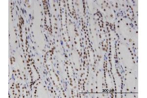 Immunoperoxidase of monoclonal antibody to DDX11 on formalin-fixed paraffin-embedded human kidney. (DDX11 antibody  (AA 1-970))
