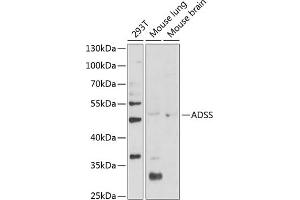 Western blot analysis of extracts of various cell lines, using ADSS Antibody (ABIN6131467, ABIN6136604, ABIN6136606 and ABIN6216015) at 1:1000 dilution. (ADSS antibody  (AA 1-280))