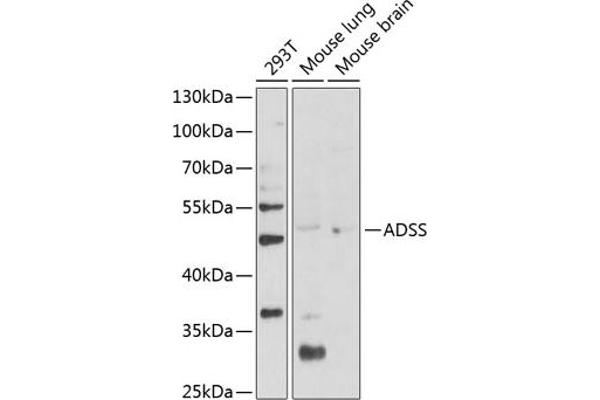 ADSS 抗体  (AA 1-280)