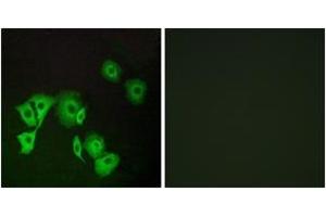 Immunofluorescence analysis of A549 cells, using TTF2 Antibody.