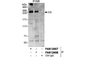 Detection of Human CIC/Capicua by Western blot and Immunoprecipitation.