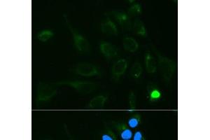 Immunofluorescence analysis of MCF-7 cells using UGT1A9 Polyclonal Antibody (UGT1A9 antibody)