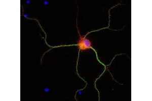 Immunofluorescence labeling of PFA fixed rat hippocampus neurons with anti-tomosyn (dilution 1 : 500; red) and mouse anti-MAP 2, (cat. (STXBP5 antibody  (AA 1031-1103))