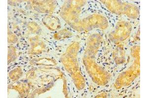 Immunohistochemistry of paraffin-embedded human kidney tissue using ABIN7173838 at dilution of 1:100 (TNFRSF1D (AA 257-386) antibody)