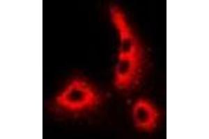 Immunofluorescent analysis of Dermcidin staining in MCF7 cells. (Dermcidin antibody)