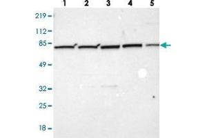 Western blot analysis of Lane 1: Human cell line RT-4, Lane 2: Human cell line U-251MG sp, Lane 3: Human cell line A-431, Lane 4: Human liver tissue, Lane 5: Human tonsil tissue with ZC3H12B polyclonal antibody . (ZC3H12B antibody)