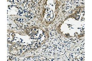 IHC analysis of VCL using anti-VCL antibody (ABIN7599003). (Vinculin antibody  (AA 1-149))