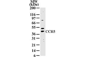 Image no. 1 for anti-Chemokine (C-C Motif) Receptor 5 (CCR5) (AA 324-340) antibody (ABIN208379) (CCR5 antibody  (AA 324-340))