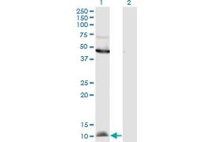 Western Blot analysis of CCL2 expression in transfected 293T cell line by CCL2 monoclonal antibody (M11), clone 3H7. (CCL2 antibody  (AA 1-99))