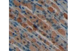 Used in DAB staining on fromalin fixed paraffin- embedded Kidney tissue (NUAK1 antibody  (AA 404-651))