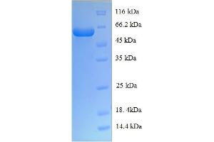 SDS-PAGE (SDS) image for CP125 (AA 1-433), (full length) protein (His-SUMO Tag) (ABIN4980398) (CP125 (AA 1-433), (full length) protein (His-SUMO Tag))