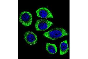 Confocal immunofluorescent analysis of PIP5KL1 Antibody (N-term) (ABIN655244 and ABIN2844847) with U-251MG cell followed by Alexa Fluor 488-conjugated goat anti-rabbit lgG (green). (PIP5KL1 antibody  (N-Term))