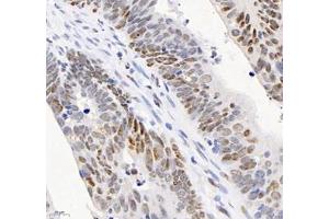 Immunohistochemistry (Paraffin-embedded Sections) (IHC (p)) image for anti-Adrenergic, alpha-1B-, Receptor (ADRA1B) antibody (ABIN7072974)