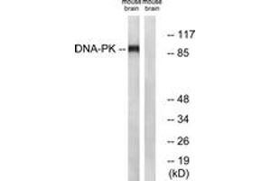 Western blot analysis of extracts from mouse brain cells, using Dynamin-1 (Ab-774) Antibody.