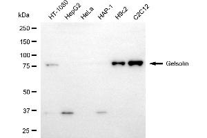 Western blotting analysis using gelsolin antibody (ABIN7798701).